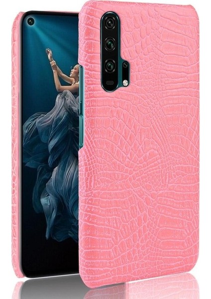 Onur 20 Pro Klasik Timsah Moda Koruyucu Için Şık Klasik Durumda (Yurt Dışından)