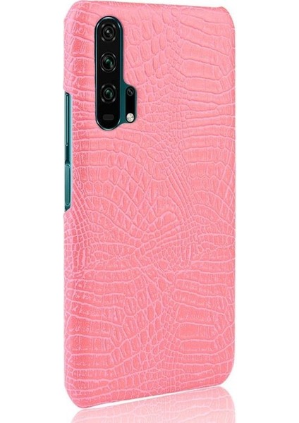 Onur 20 Pro Klasik Timsah Moda Koruyucu Için Şık Klasik Durumda (Yurt Dışından)