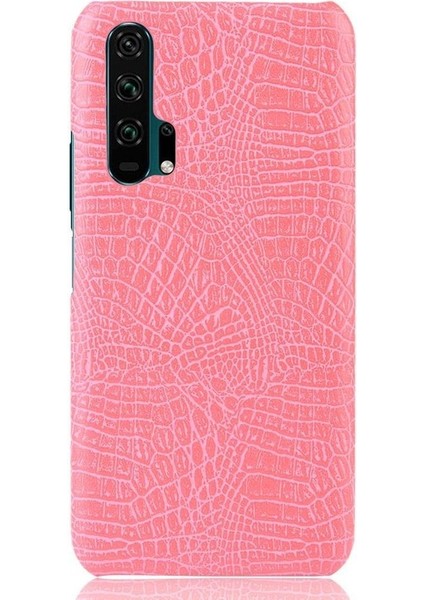Onur 20 Pro Klasik Timsah Moda Koruyucu Için Şık Klasik Durumda (Yurt Dışından)