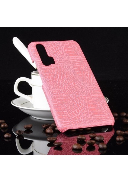 Onur 20 Pro Klasik Timsah Moda Koruyucu Için Şık Klasik Durumda (Yurt Dışından)