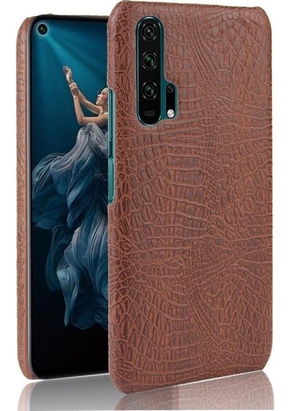 Onur 20 Pro Klasik Timsah Moda Koruyucu Için Şık Klasik Durumda (Yurt Dışından)