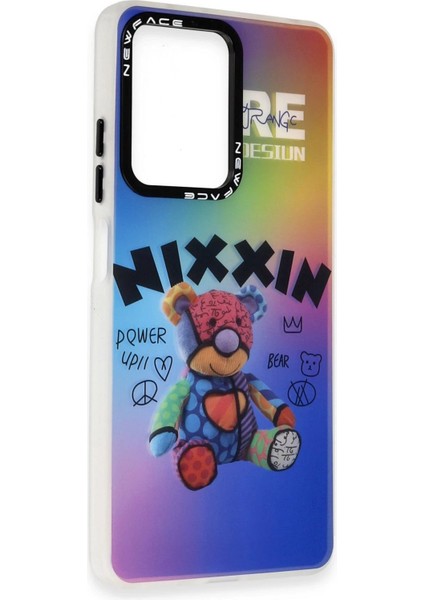 Newface Xiaomi Redmi Note 12 4g Kılıf Estoril Desenli Kapak - Estoril - 11