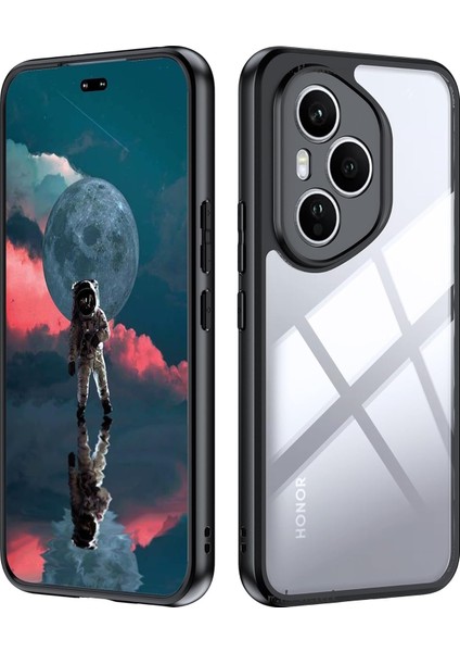 Honor 400 Pro Kılıf Kamera Korumalı Kenarları Renkli Arkası Şeffaf Yumuşak Kenarlı Silikon Sert Kapak