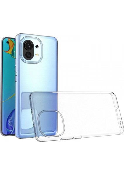 Newface Xiaomi Mi 11 Kılıf Lüx Şeffaf Silikon