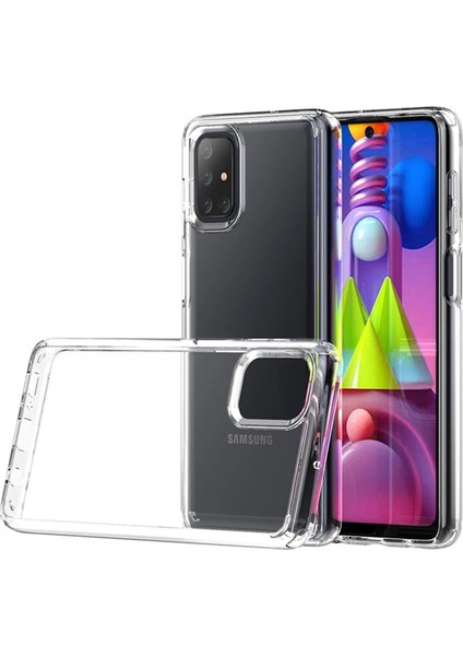 Newface Samsung Galaxy M51 Kılıf Lüx Şeffaf Silikon