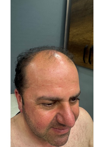 Protez Saç New Ancora 7X10 Koyu Kahve,ınce Telli Her Yöne Taranabilen Alt Yapı %100 Insan Saçı fırsatları