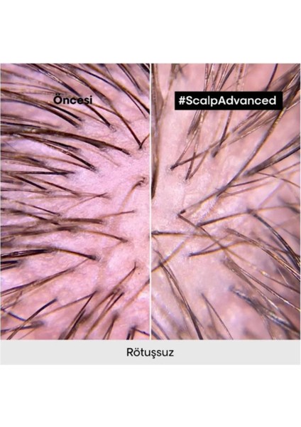 L'oreal Key Pro Serıe Serie Expert Scalp Advanced Profesyonel Şampuan 500ML modelleri