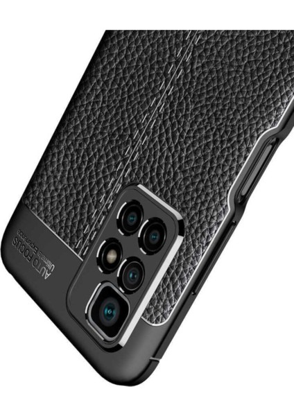 Xiaomi Redmi 10 Kılıf Rugan Armor Deri Görünümlü Parmak İzi Yapmaz Dayanıklı Niss Silikon Kapak