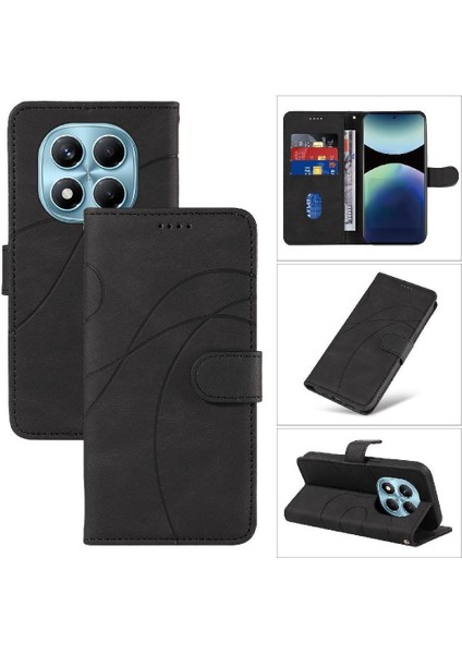 Xiaomi Redmi Not 14 Pro 4g Cilt Hissediyorum Deri ve Buzlu Için Flip Case (Yurt Dışından) indirimleri
