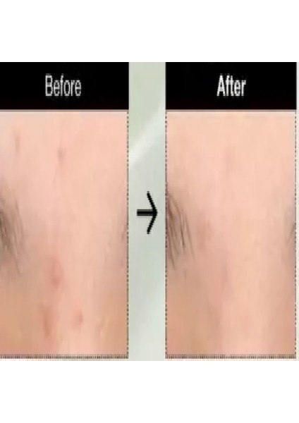 - Heartleaf Centella Red Spot Cream(Leke Kremi)(Globalcare) modelleri