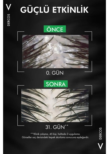 Vichy Dercos Anti-Pelliculaire Anti-Dandruff Şampuan 390 ml - Normal ve Yağlı Saçlar modelleri