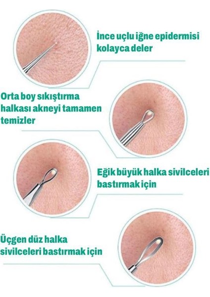 Paslanmaz Çelik Siyah Nokta Temizleyici 5'li Komedon Seti