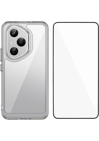 Honor 400 Pro 5g Tpu Akrilik Şeffaf Telefon Kılıfı Temperli Cam Filmi ile (Yurt Dışından)