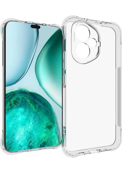 Honor 400 5g Şeffaf Tpu Kılıf Telefon Arka Kapağı (Yurt Dışından)