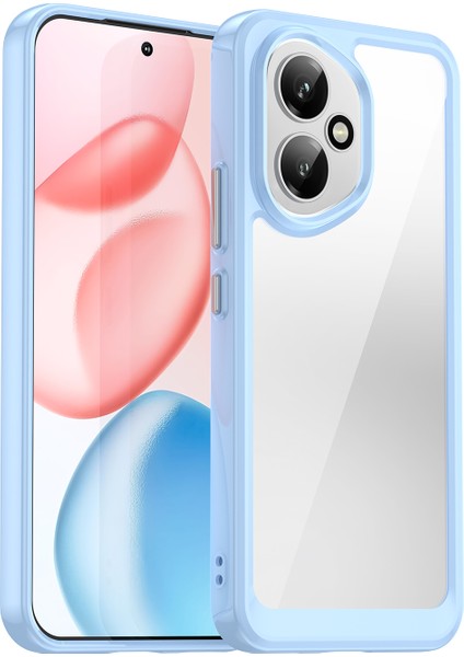 Honor 400 5g Telefon Kılıfı Tpu Akrilik Kapaklı Temperli Cam (Yurt Dışından) fiyatları