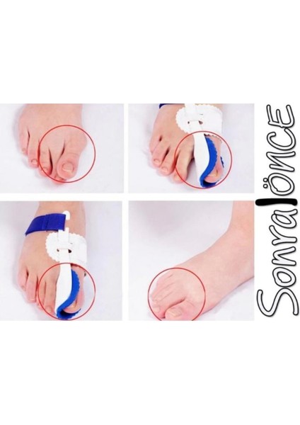 Baş Parmak Kemik Düzeltici Gece Ateli (Çift) fiyatları