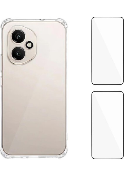 Honor 400 5g Tpu Kılıf 1.5mm Telefon Kılıfı 2 Adet Temperli Cam Filmleri ile (Yurt Dışından)
