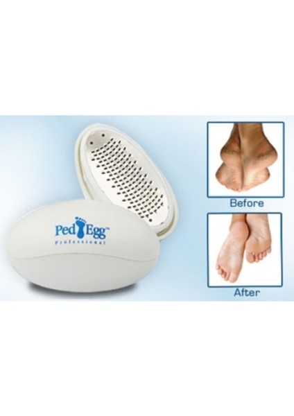 Topuk Bakım Seti, Güzel ve Sağlıklı Ayaklar Için Törpü Kutusu