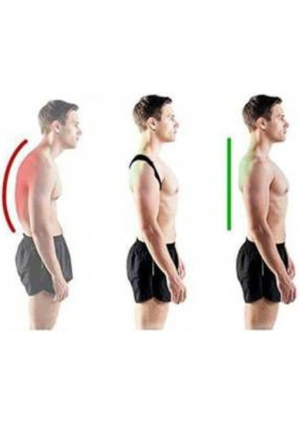 Deri Desenli, Kemerli, Ortopedik, Omuz ve Dik Duruş Destekleyici Korsen Siyah Renk