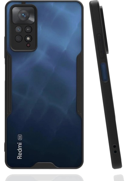 Xiaomi Redmi Note 11 Pro Kılıf Platin Silikon - Siyah - YKD7389-5777