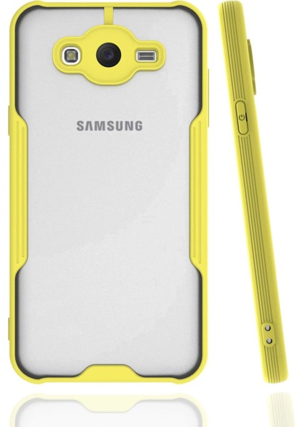 Samsung Galaxy J7 Kılıf Platin Silikon - Sarı - YKD4919-1277