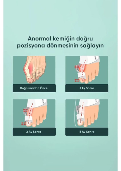 Ayak Baş Parmak Düzeltici Silikon Çorap, Konfor ve Sağlık Destekli Tasarım fiyatları