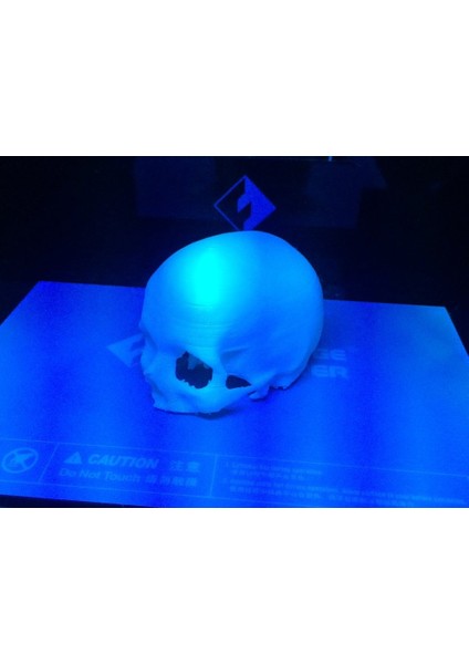 Celebrex Insan Kafatası Ameliyatı Sonrası (Plastik Aparattır!!!) 3D fiyatları