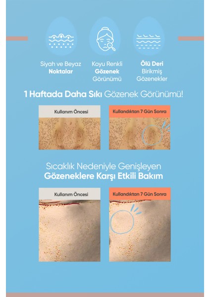 Cilde Aydınlık ve Pürüzsüz Görünüm Kazandıran Gözenek Karşıtı Serum A'PIEU Egg Pha Pore Serum