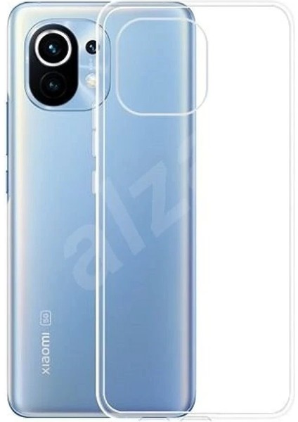 Xiaomi Mi 11 Kılıf Lüx Şeffaf Silikon - KA8573-6490 fiyatları
