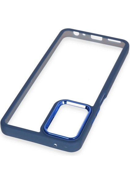 Realme 10 Pro 5g Kılıf Dora Kapak - Mavi - KA1193-4373 fırsatları