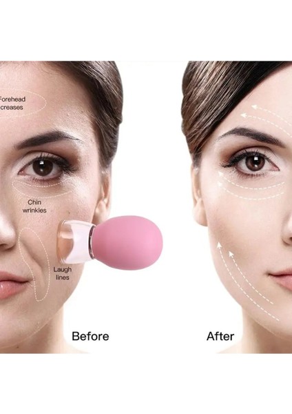 Vakumlu Silikon Yüz ve Boyun Masaj Kupası 1 Adet