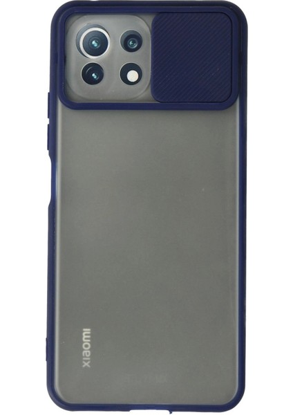 Xiaomi Mi 11 Lite Kılıf Palm Buzlu Kamera Sürgülü Silikon - Lacivert - CPT106384-7797