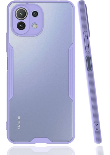 Xiaomi Mi 11 Lite Kılıf Platin Silikon - Lila - CPT108123-8468