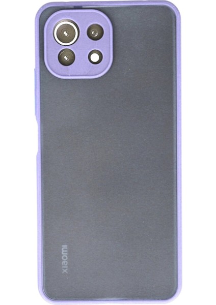 Xiaomi Mi 11 Lite Kılıf Montreal Silikon Kapak - Mor - NFND4060-4557