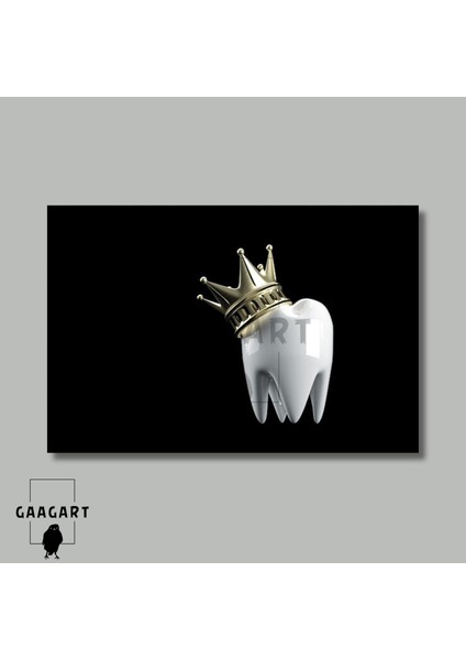 Tekli Yatay Kanvas Diş Poliklinik Tablosu Kral Diş modelleri