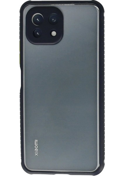 Xiaomi Mi 11 Lite Kılıf Miami Şeffaf Silikon - Lacivert - NFND3659-8139