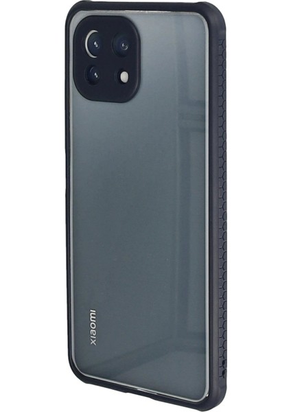 Xiaomi Mi 11 Lite Kılıf Miami Şeffaf Silikon - Lacivert - NFND3659-8139 modelleri