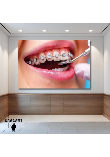 Tekli Yatay Kanvas Diş Poliklinik Tablosu Pırtlanta Diş Teli