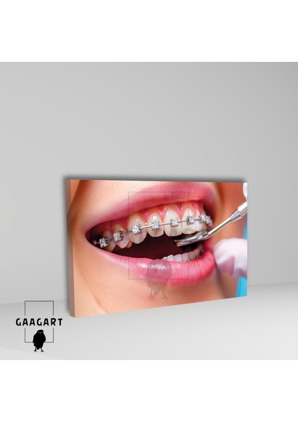 Tekli Yatay Kanvas Diş Poliklinik Tablosu Pırtlanta Diş Teli fiyatları