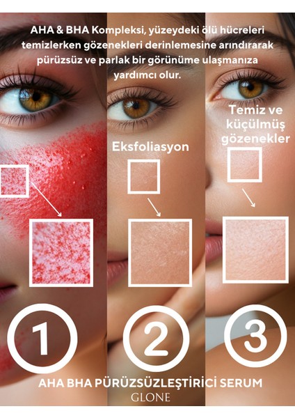 Aha Bha Pürüzsüzleştirici Serum 30ML | Hyaluronik Acid, Glycolic Acid & Centella Asiatica Içeriği fırsatları