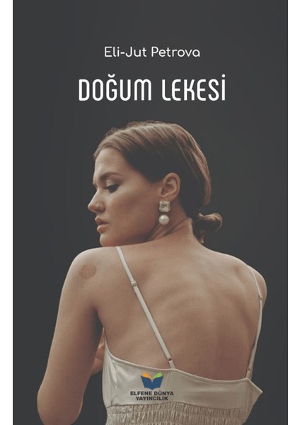 Doğum Lekesi