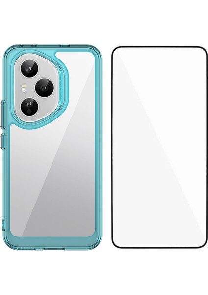 Honor 400 Pro 5g Telefon Kılıfı Tpu Akrilik Kapak Temperli Camlı (Yurt Dışından)