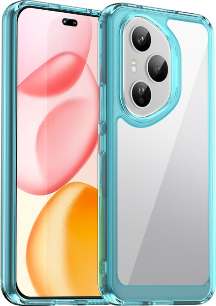 Honor 400 Pro 5g Telefon Kılıfı Tpu Akrilik Kapak Temperli Camlı (Yurt Dışından) fiyatları