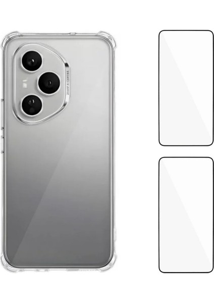Honor 400 Pro 5g Tpu Telefon Kılıfı Temperli Cam Filmi ile (Yurt Dışından)