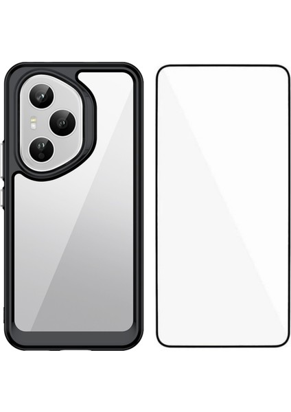 Honor 400 Pro 5g Telefon Kılıfı Tpu Akrilik Kapak Temperli Camlı (Yurt Dışından)