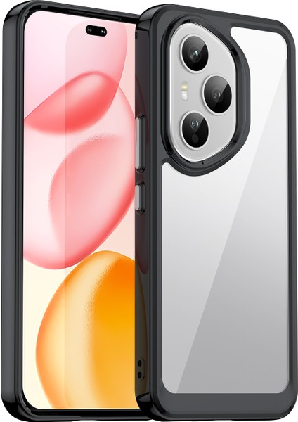 Honor 400 Pro 5g Telefon Kılıfı Tpu Akrilik Kapak Temperli Camlı (Yurt Dışından) fiyatları