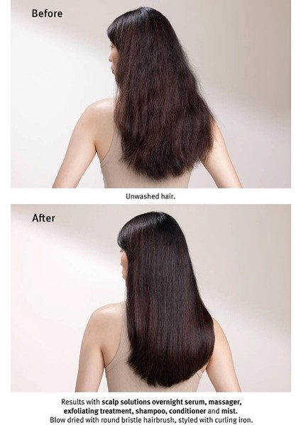 Scalp Solutions Saç Derisi Için Şampuan 1000ML fırsatları