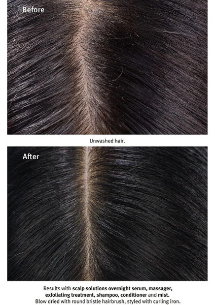 Scalp Solutions Saç Derisi Için Şampuan 1000ML indirimleri