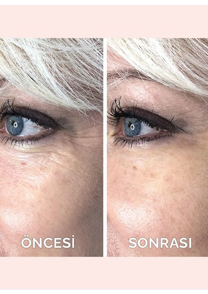 Instant Ageback 15ML modelleri