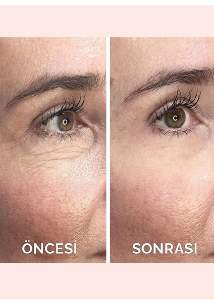 Instant Ageback 15ML fırsatları